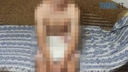 У Житомирі пильна сусідка допомогла затримати квартирного злодія