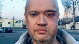 У Житомирі розшукують безвісно зниклого 48-річного Сергія Жебка