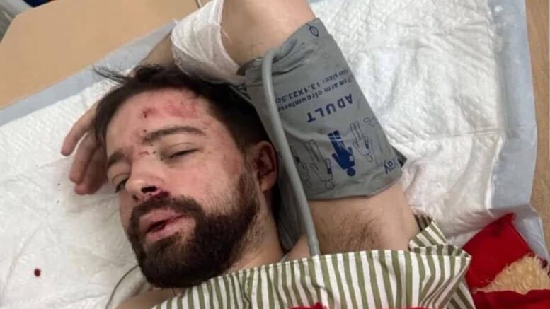 На узбіччі під Житомиром з пробитим черепом знайшли співробітника львівського вишу, якого напередодні забрало ТЦК