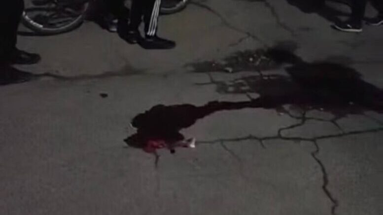У Житомирі під час сварки 12-річний хлопець підрізав 11-річну дівчинку