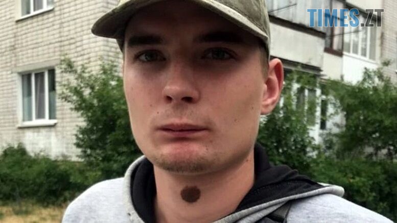 На Житомирщині розшукують безвісно зниклого 20-річного Віктора Орлова