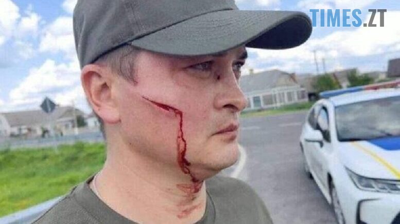 На Волині чоловік з допомогою лопати відбився від співробітників ТЦК