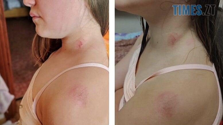 події в житомирі