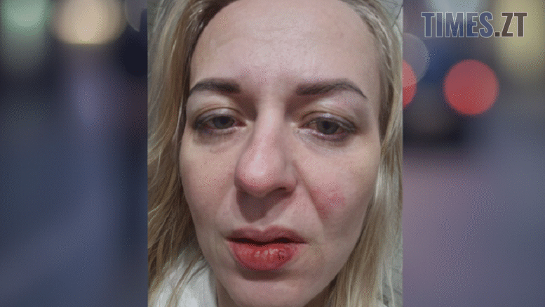 Напад на жінку у Житомирі: поліція встановила особу хулігана