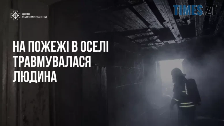 У Коростишеві під час самостійного гасіння пожежі травмувався чоловік
