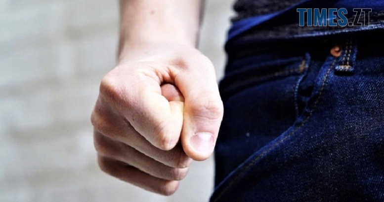 У Житомирі підлітки побили 9-річну дитину: поліція розпочала розслідування
