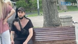 У Житомирі чоловік жорстоко побив 87-річного пенсіонера: поліція встановила особу нападника